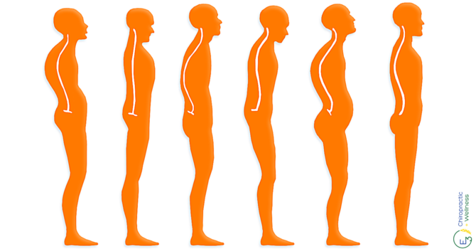 The Truth About Posture  image