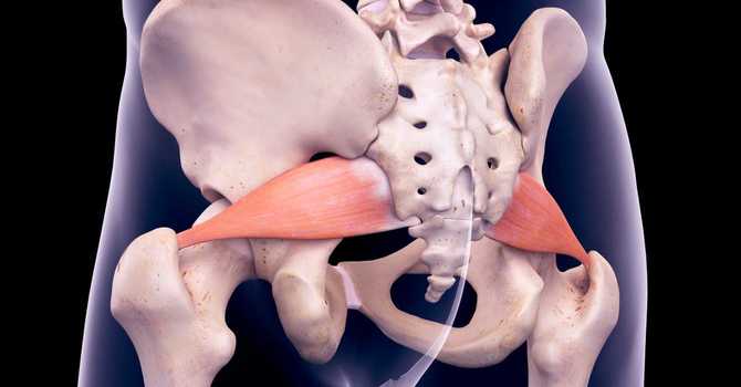Finding Relief from Piriformis Syndrome image