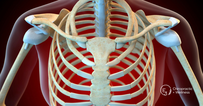 What is Thoracic Outlet Syndrome image